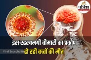 Encephalitis Symptoms