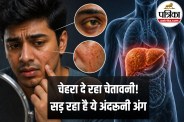 Fatty Liver Signs on Face