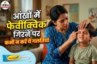 What to do if Fevikwik gets into the eye