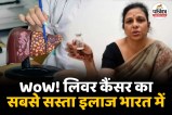 cheapest Therapy for liver cancer, लिवर कैंसर का सबसे सफल इलाज क्या है, Liver कैंसर के इलाज में कितना खर्च आता है, विश्व लिवर दिवस,