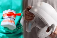 dental ailments