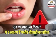 Oral Cancer Symptoms
