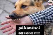 Rabies Symptoms