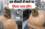 Sebaceous Horn, Sebaceous Horn Cause