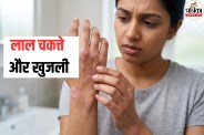 Skin Disease