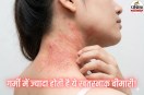 Skin Disease, Skin Disease Cause
