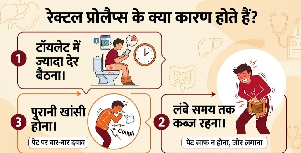 Rectal Prolapse
(Image- gemini AI)