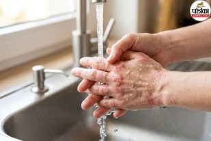 water allergy