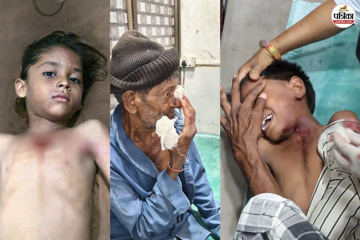 Banswara dog bite