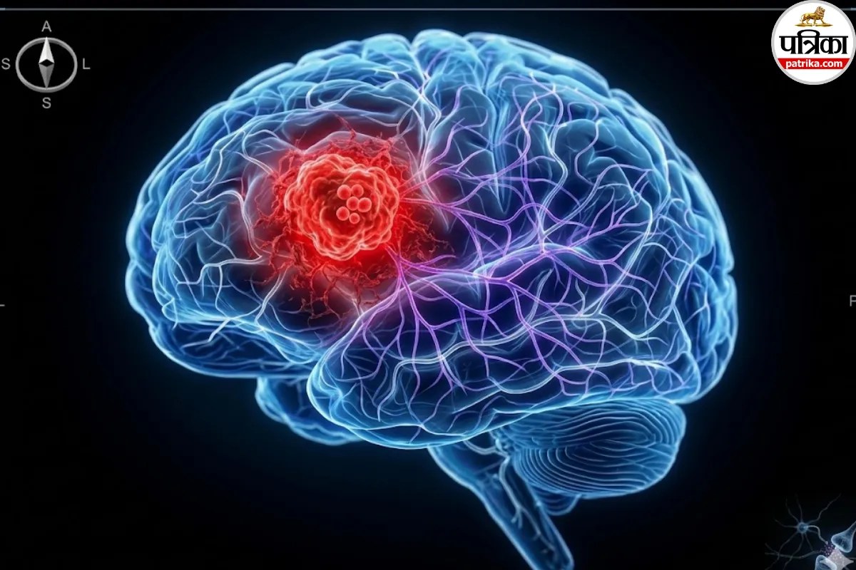 Brain tumor research, Testosterone and brain cancer, Glioblastoma treatment,