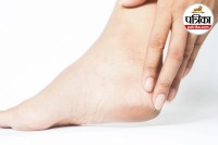 Cracked Heels, Diabetes Signs, Thyroid Symptoms, Vitamin Deficiency,