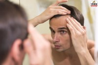 Hair Thinning, Hair Thinning in 20s, Early Hair Thinning,