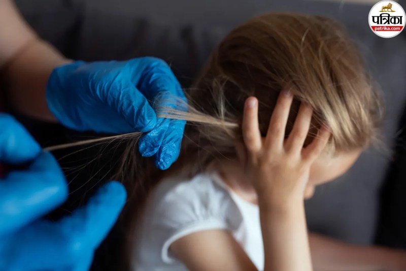 Head lice and anemia, Lice infestation causes, Scalp lice infection,