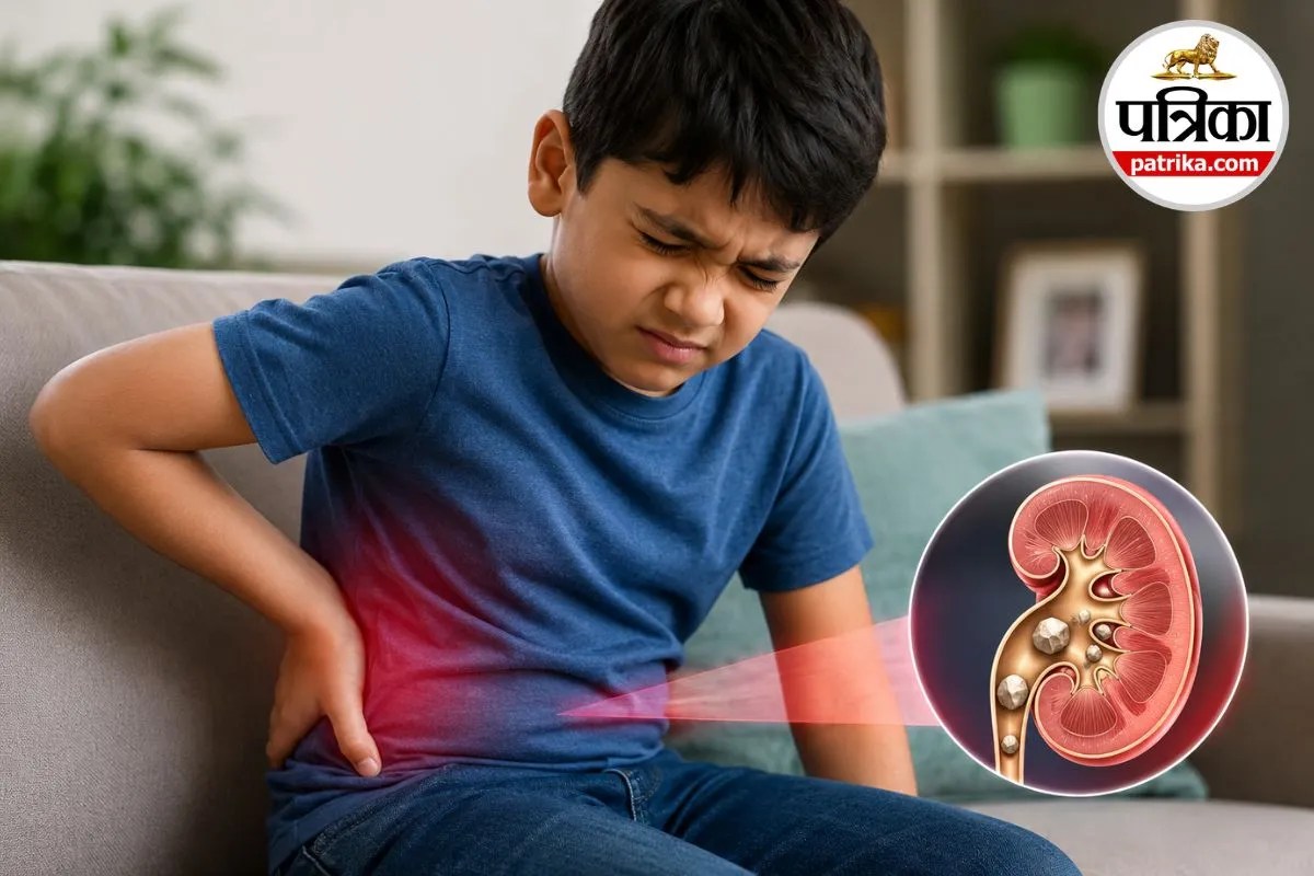 Kidney Stone, Children Health, Urology, Kidney Health,