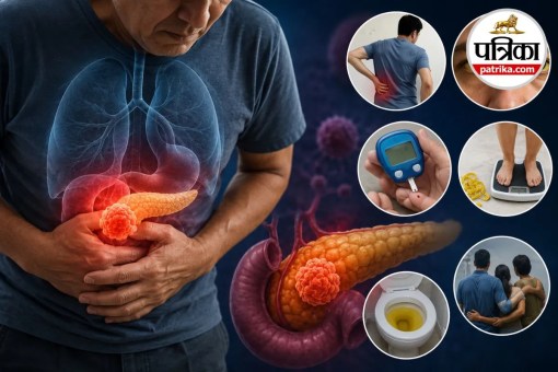 Pancreatic Cancer, Cancer Symptoms, Silent Cancer