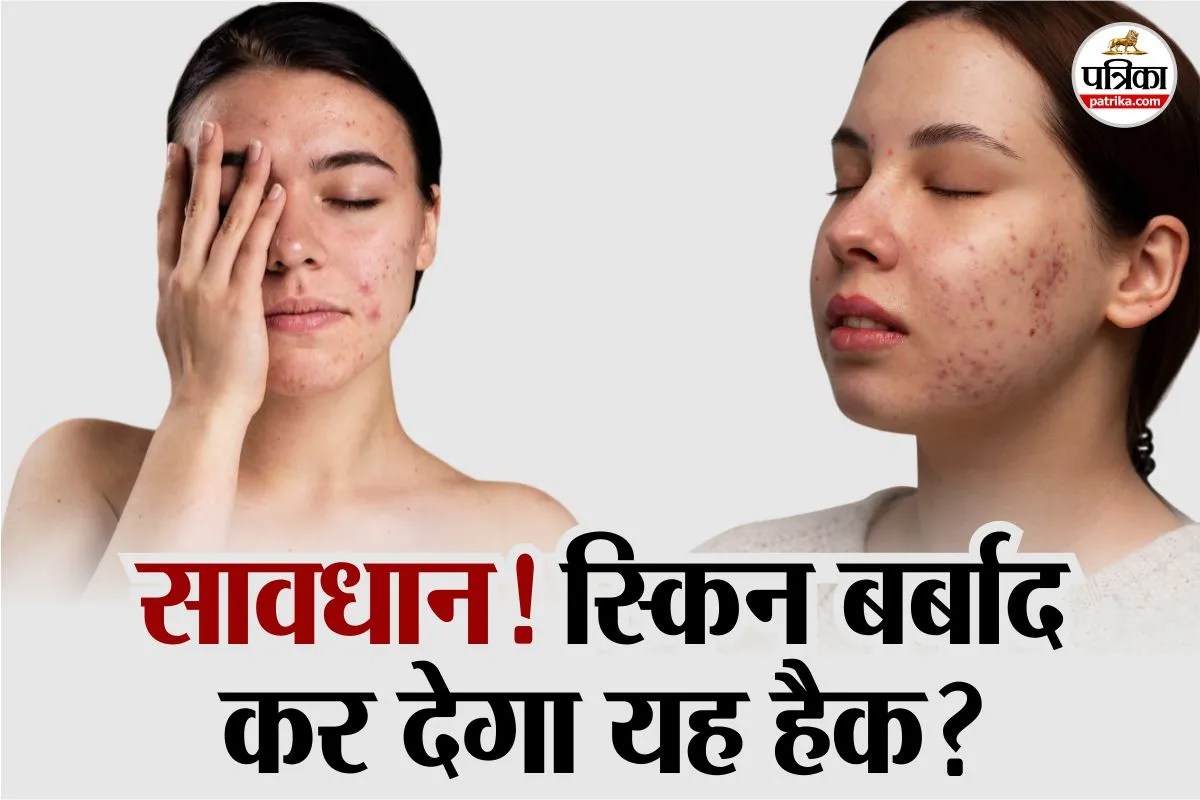 Anti Dandruff Skincare Anti Fungal Contact Dermatitis