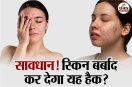 Anti Dandruff Skincare Anti Fungal Contact Dermatitis