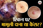 Silent Damage UV Radiation Cellular Mutation Sun-Smart Lifestyle