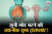 Womb transplant Surrogacy mother Child Birth Uterus Implanted