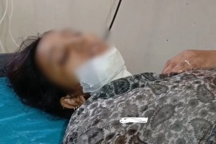 Woman attacked with blade