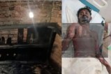 Woman sets lover on fire