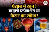 Kidney infection Cancer Urine infection Painless Hematuria Intense Workout Water Intake Capacity