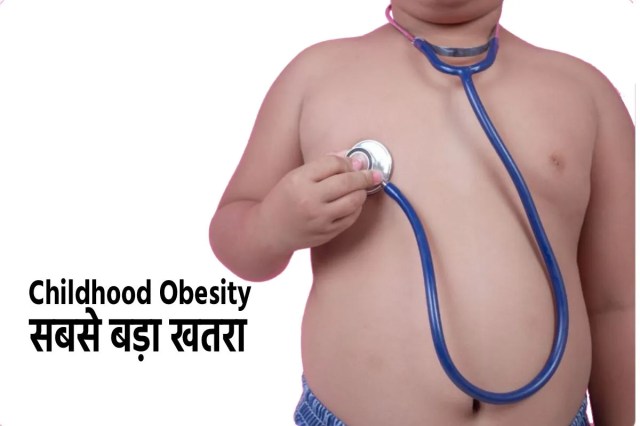 childhood obesity