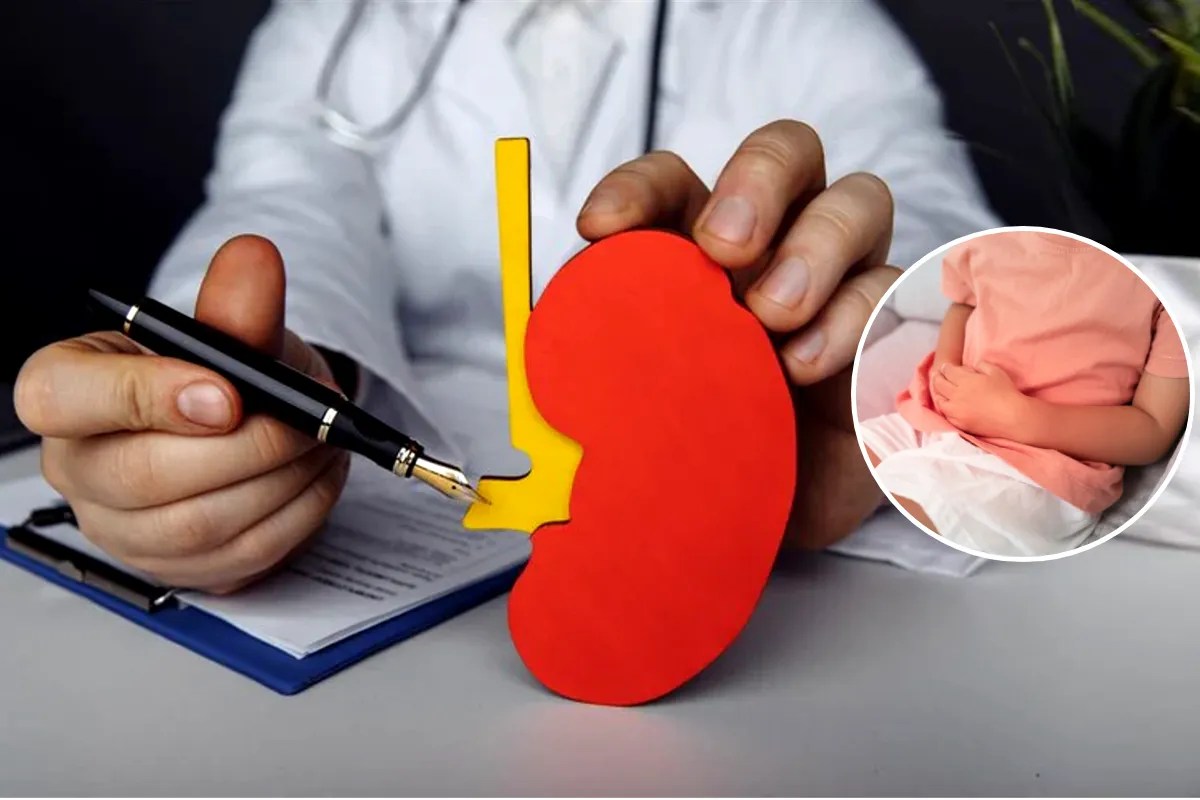 kidney stone patients