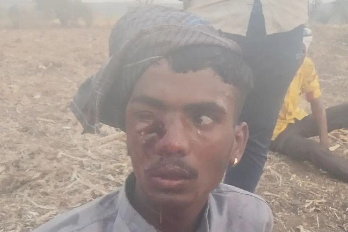 Leopard attacks two shepherds in Nagoni