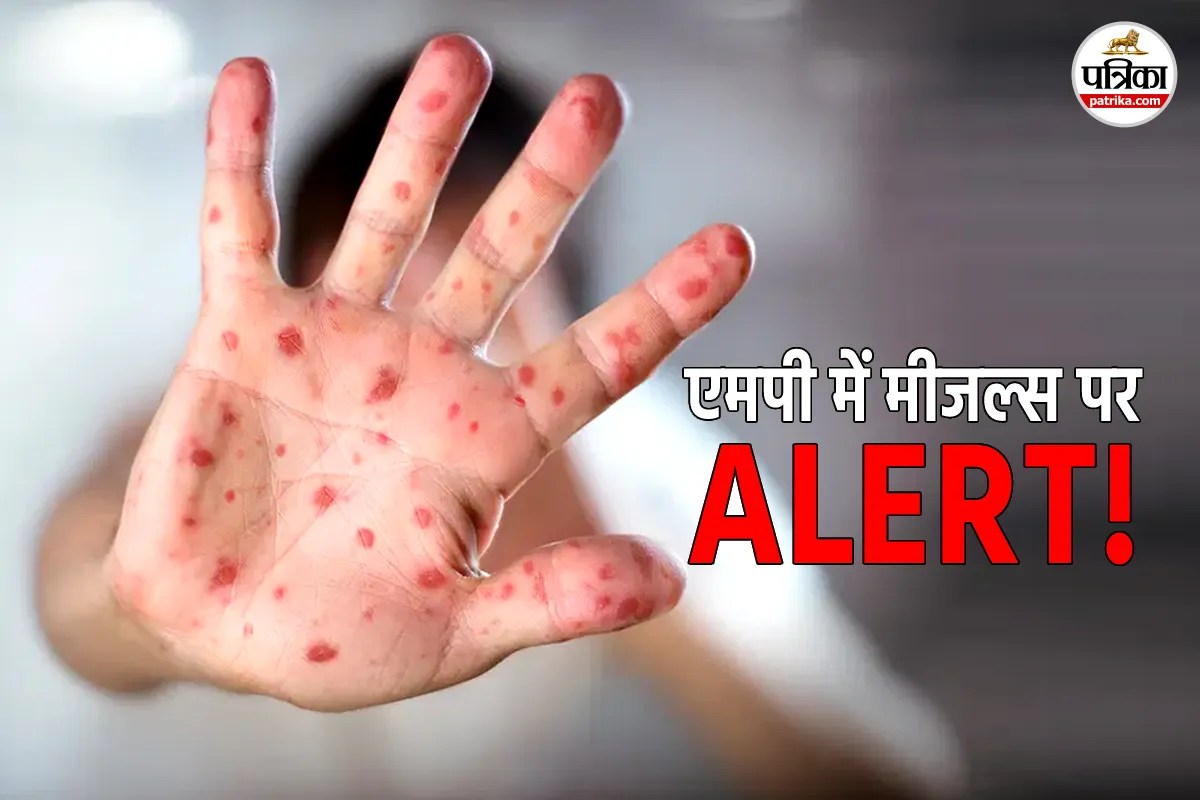 Measles Alert in MP