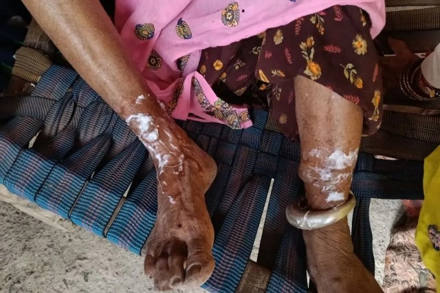woman silver anklets robbery