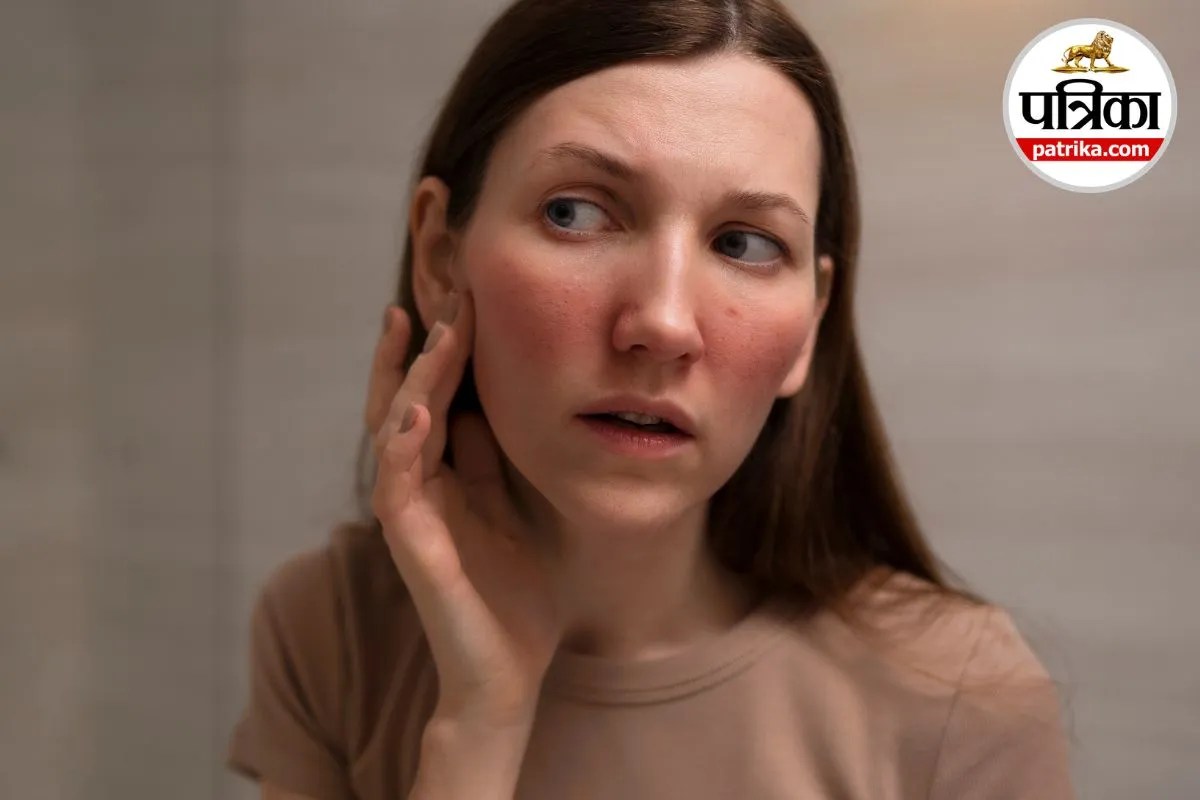Angioedema Facial Swelling Lip Swelling Eye Swelling