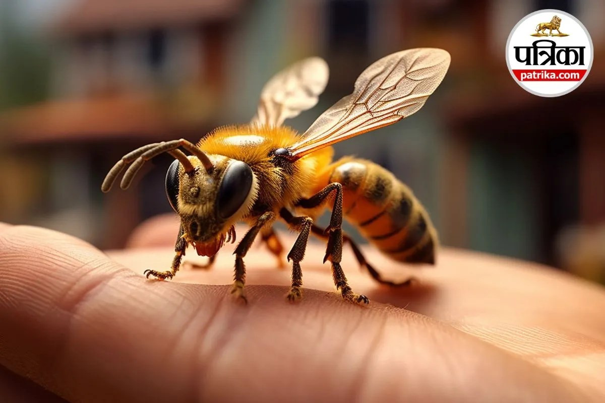 Bee Sting Allergy,Bee Sting First Aid