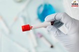 Blood cancer early symptoms and signs , Cleveland Clinic blood cancer research , Nature Journal blood cancer study,