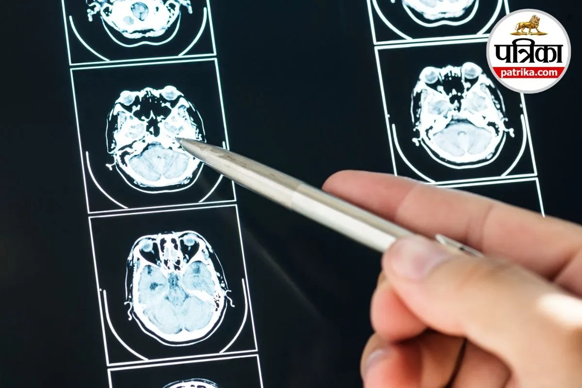 Brain Tumor Grade 4 Brain Tumor Report WHO Brain Tumor Classification