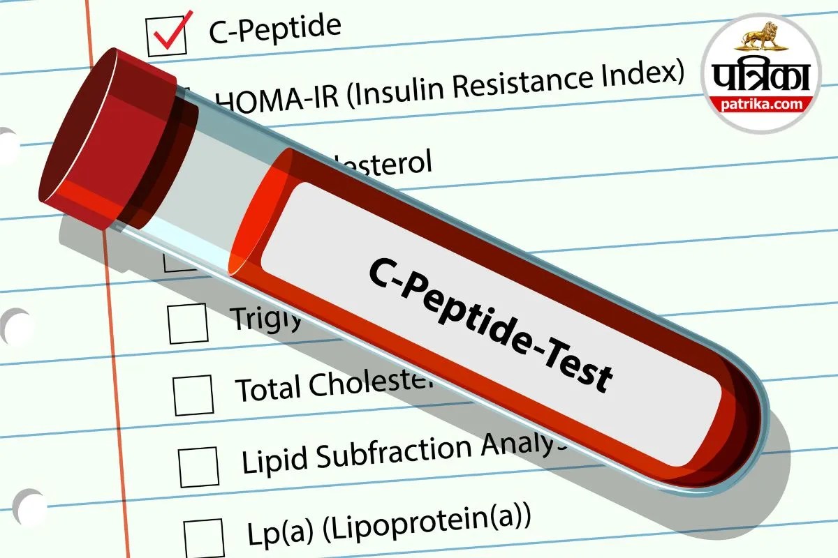 C-Reactive Protein Test High CRP CRP Blood Test