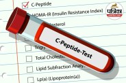 C-Reactive Protein Test High CRP CRP Blood Test