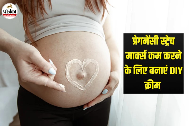DIY Cream For Stretch Marks, How To Prevent Pregnancy Stretch Marks