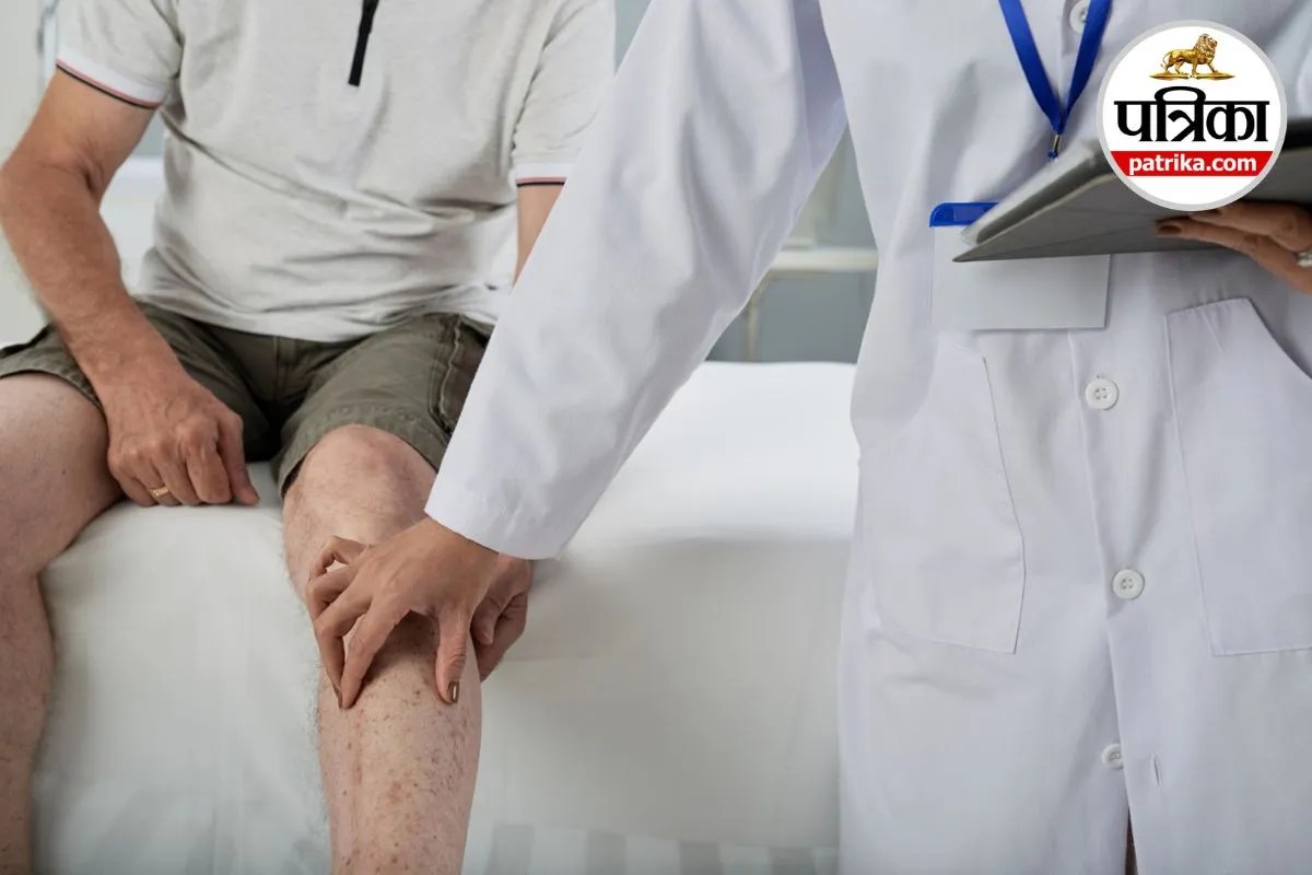 Deep Vein Thrombosis Causes and Symptoms