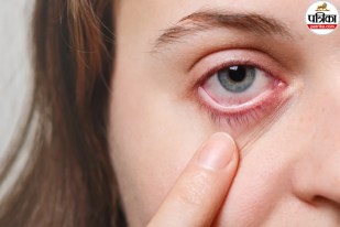 dry eyes causes, dry eyes reasons, what causes dry eyes,