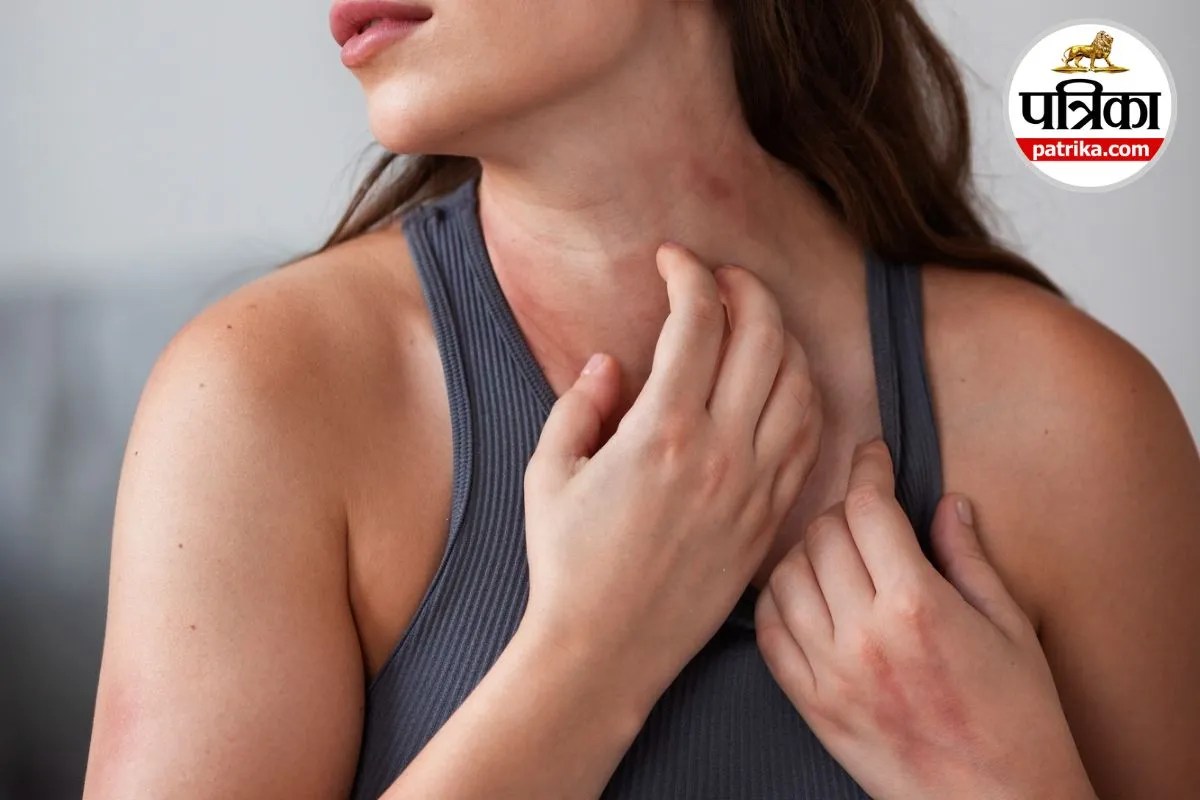 Eczema in Hindi Eczema Symptoms Atopic Dermatitis