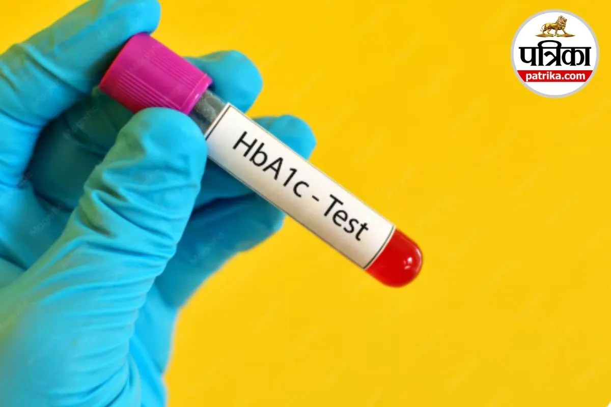 HbA1c Test A1C Test Diabetes Test