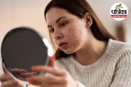 Hormonal Acne, Periods, PCOS, Women's Health,