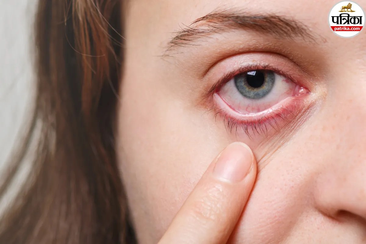 pink eye symptoms when to see a doctor, monsoon eye infection conjunctivitis, mayo clinic pink eye guidelines,