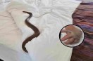 snake bite: मासूम को सांप ने काट लिया (Photo Source - Patrika)
