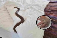 snake bite: मासूम को सांप ने काट लिया (Photo Source - Patrika)