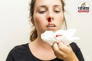 Nosebleed Causes, Epistaxis, Frequent Nosebleeds,