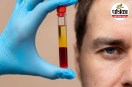 P-Shot PRP Injection Platelet Rich Plasma Erectile Dysfunction