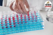 Reticulocyte Count Test, Blood Test, Anemia, Bone Marrow,