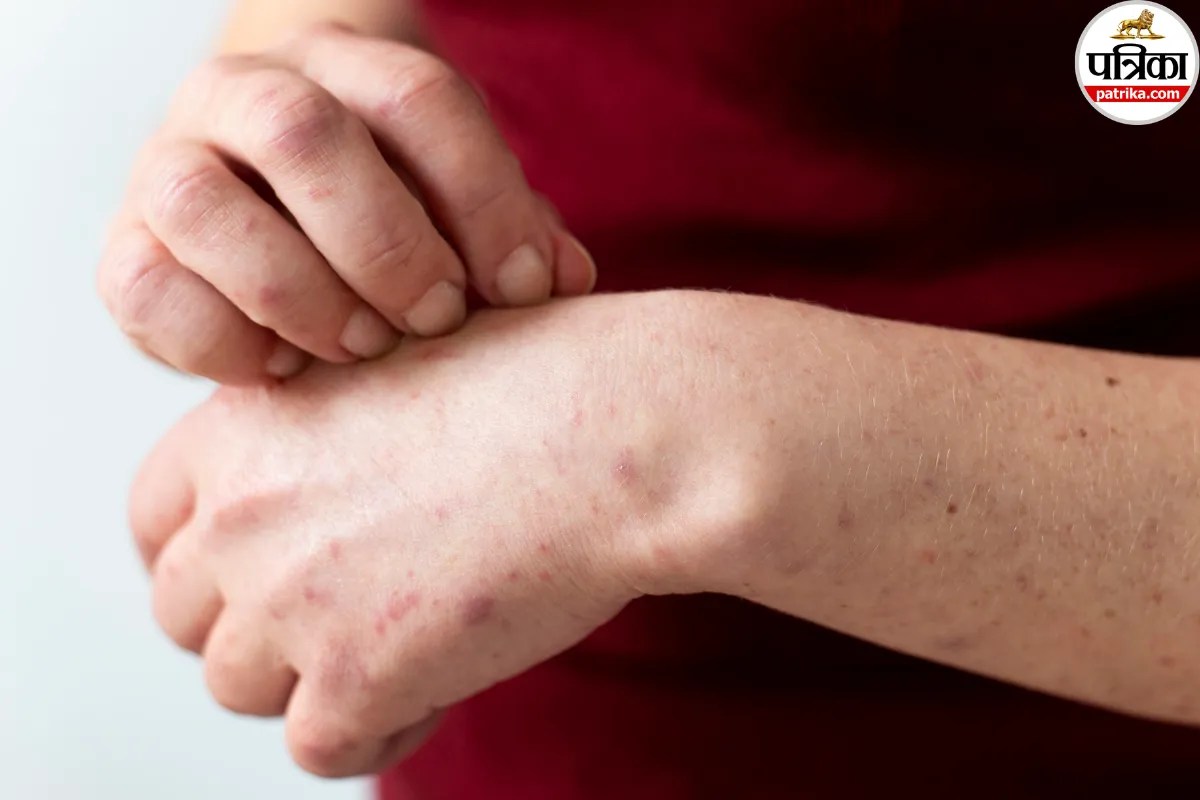 Common Skin Disease Causes,Skin Allergy Prevention Tips,Home Remedies for Skin Itching,